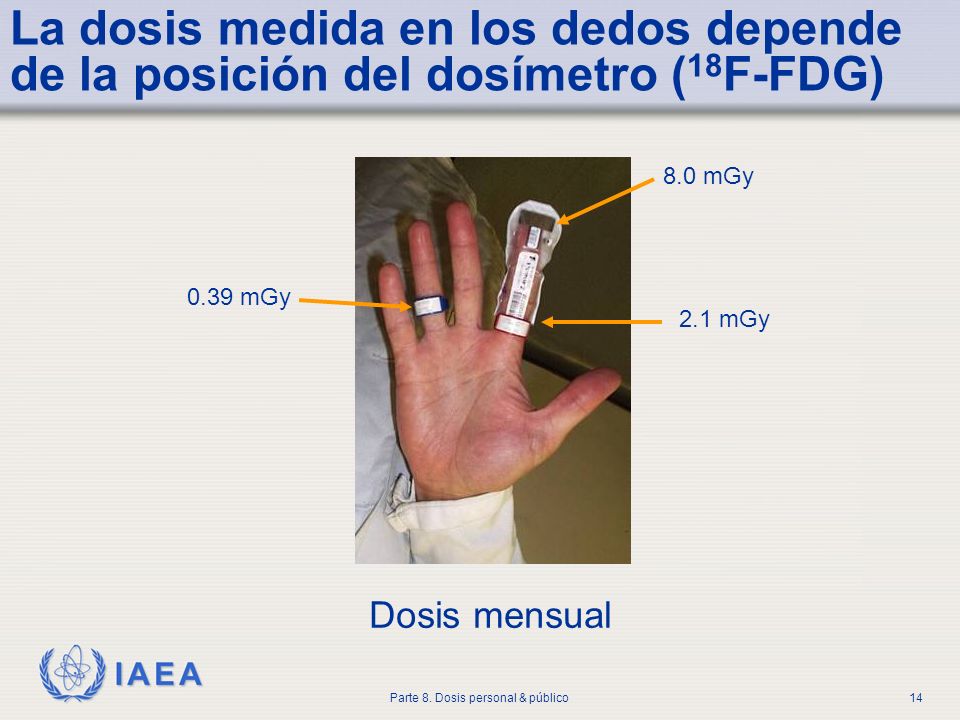 La dosis medida en los dedos depende de la posición del dosímetro (18F-FDG)