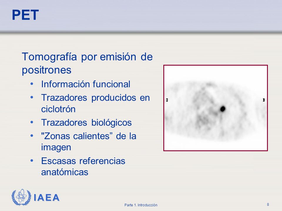 PET Tomografía por emisión de positrones Información funcional