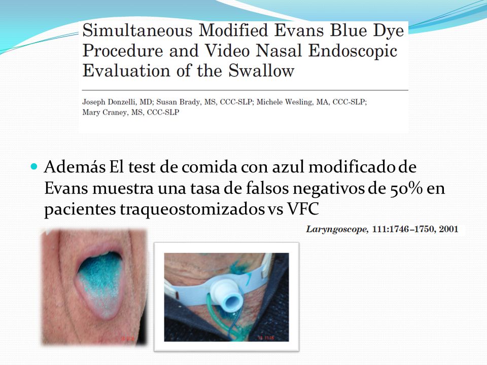 Además El test de comida con azul modificado de Evans muestra una tasa de falsos negativos de 50% en pacientes traqueostomizados vs VFC