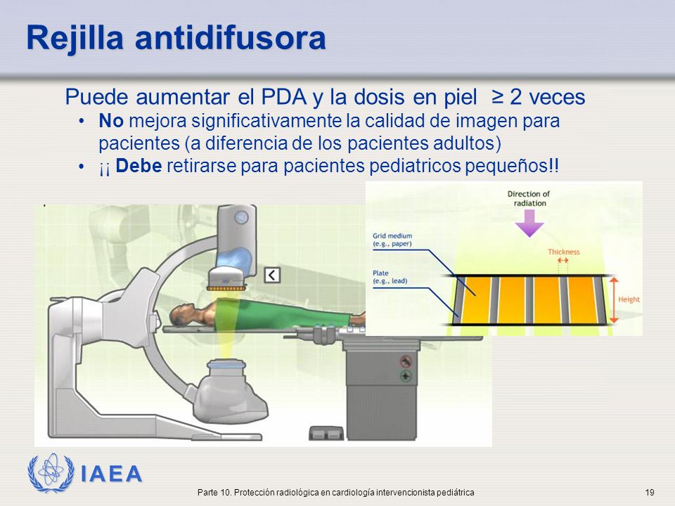 Rejilla antidifusora Puede aumentar el PDA y la dosis en piel ≥ 2 veces.