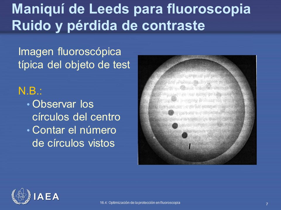 Maniquí de Leeds para fluoroscopia Ruido y pérdida de contraste