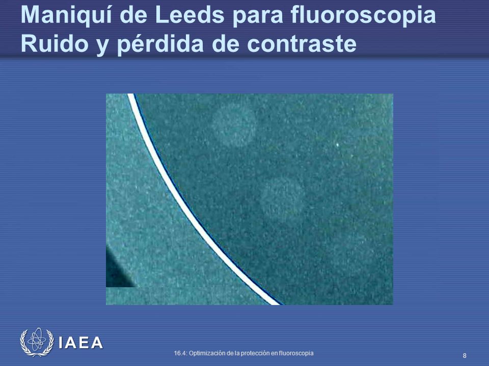 Maniquí de Leeds para fluoroscopia Ruido y pérdida de contraste