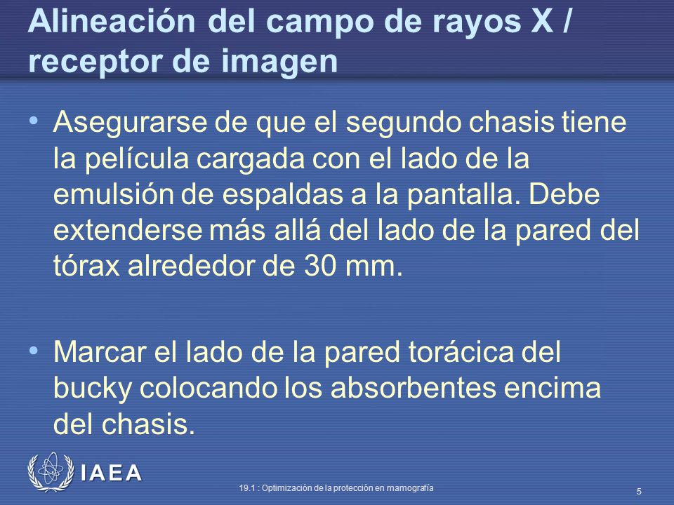 Alineación del campo de rayos X / receptor de imagen