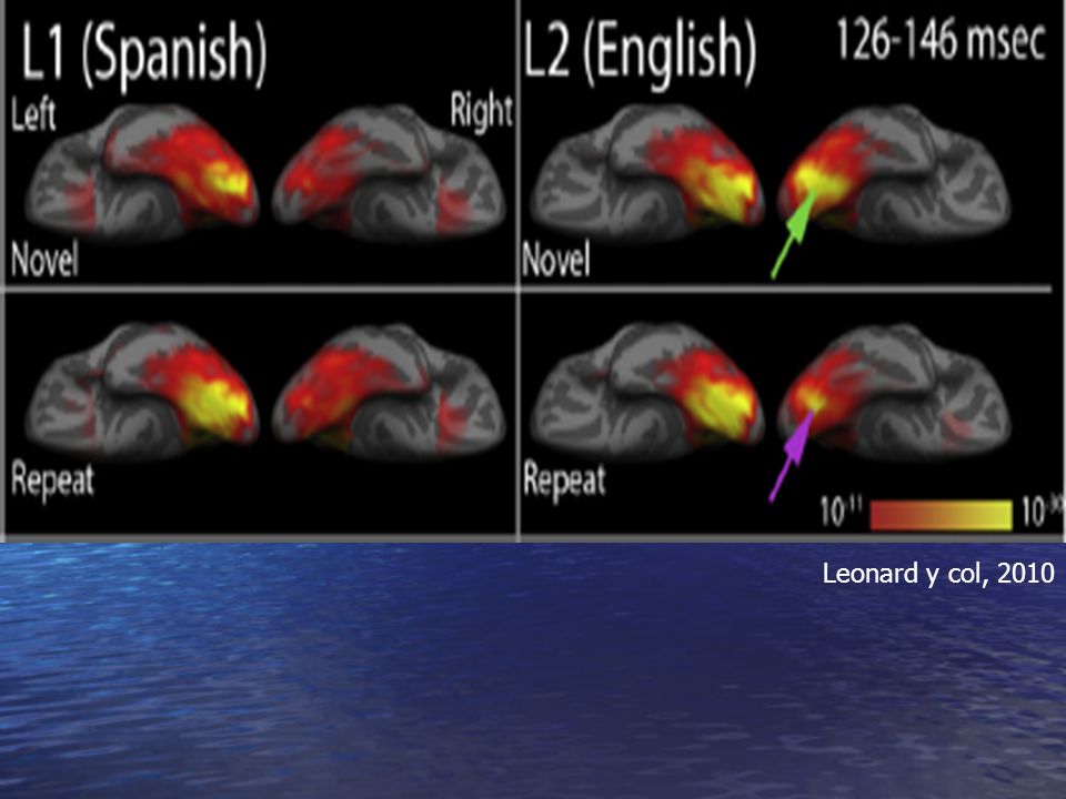 Fig. 1. Group dSPM images of the mean activity during early visual word encoding (¡«136 ms post-stimulus onset) for 11 subjects. Spanish (L1) showed strongly left lateralized