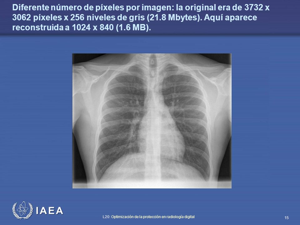 Diferente número de píxeles por imagen: la original era de 3732 x 3062 píxeles x 256 niveles de gris (21.8 Mbytes).