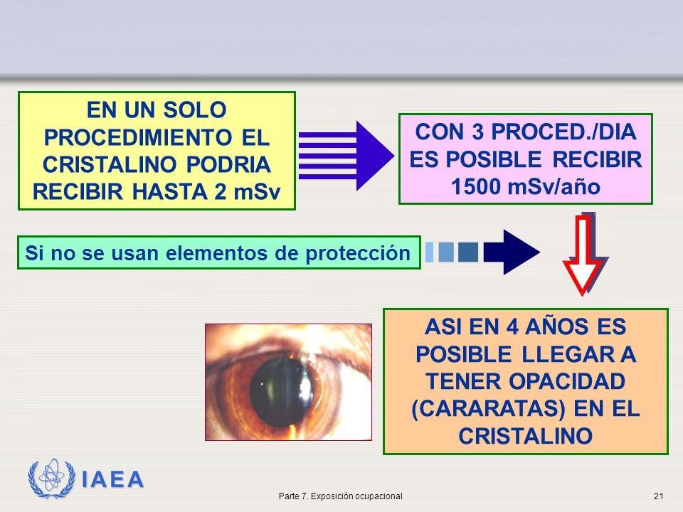 EN UN SOLO PROCEDIMIENTO EL CRISTALINO PODRIA RECIBIR HASTA 2 mSv