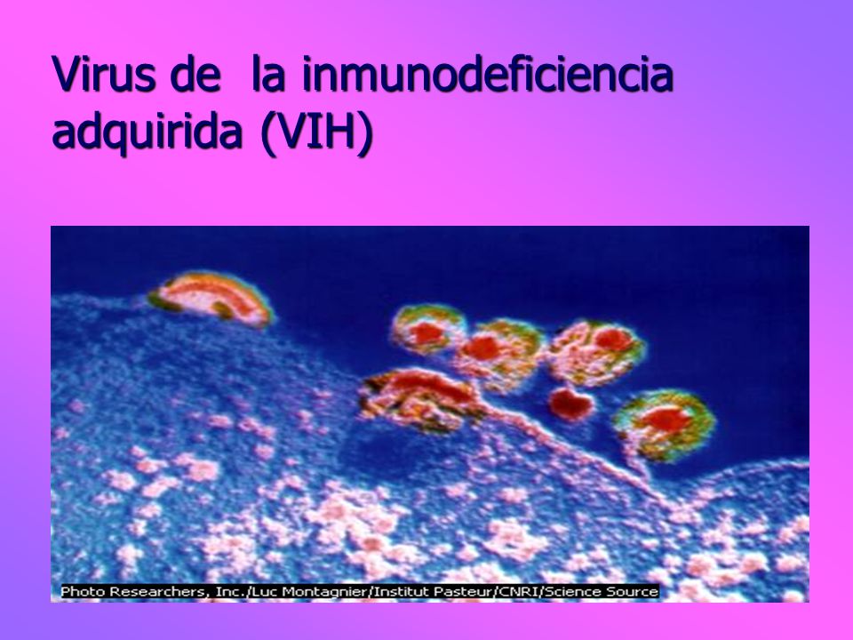 Virus de la inmunodeficiencia adquirida (VIH)