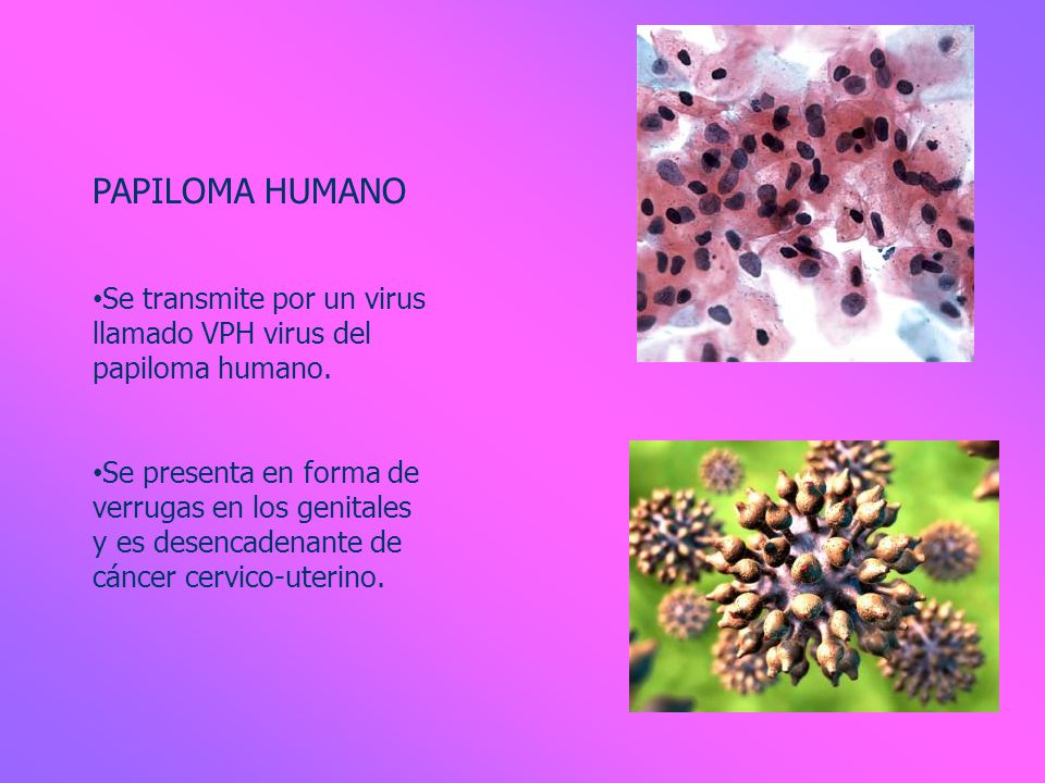PAPILOMA HUMANO Se transmite por un virus llamado VPH virus del papiloma humano.