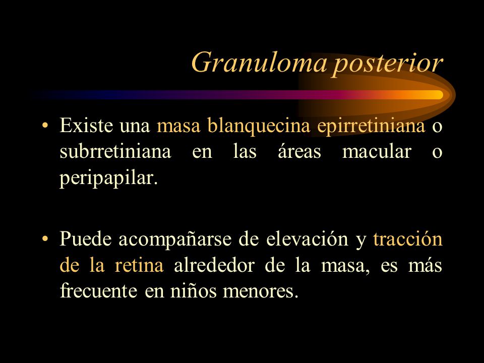 Granuloma posterior Existe una masa blanquecina epirretiniana o subrretiniana en las áreas macular o peripapilar.