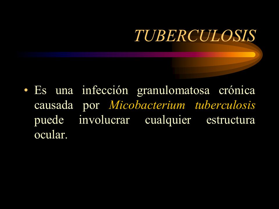 TUBERCULOSIS Es una infección granulomatosa crónica causada por Micobacterium tuberculosis puede involucrar cualquier estructura ocular.