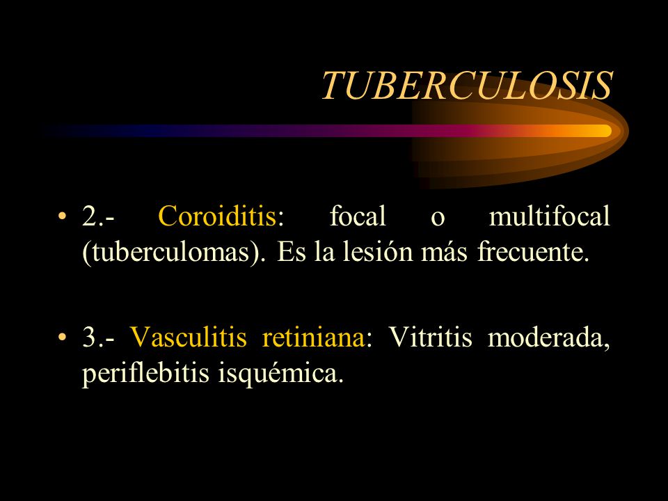 TUBERCULOSIS 2.- Coroiditis: focal o multifocal (tuberculomas). Es la lesión más frecuente.