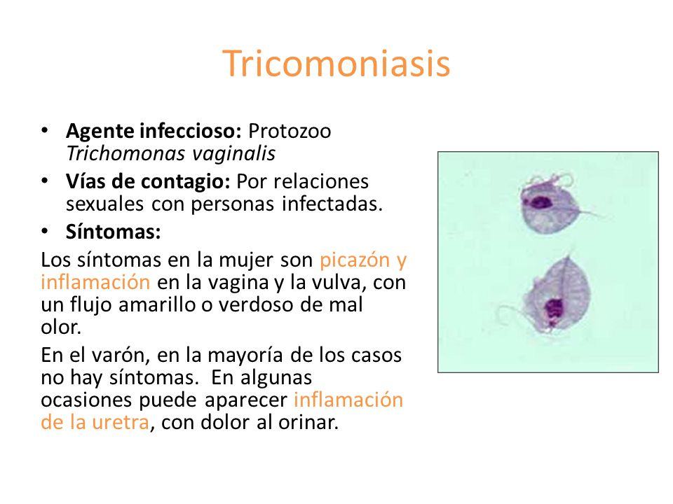 Tricomoniasis Agente infeccioso: Protozoo Trichomonas vaginalis