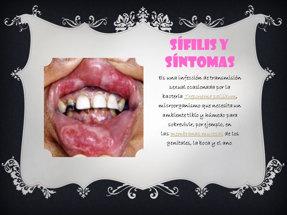 Sífilis y síntomas