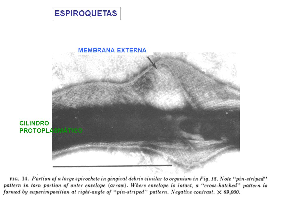 ESPIROQUETAS MEMBRANA EXTERNA CILINDRO PROTOPLASMÁTICO
