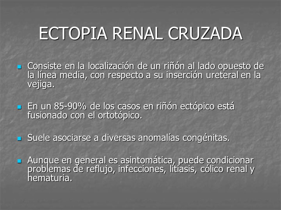 ECTOPIA RENAL CRUZADA Consiste en la localización de un riñón al lado opuesto de la línea media, con respecto a su inserción ureteral en la vejiga.