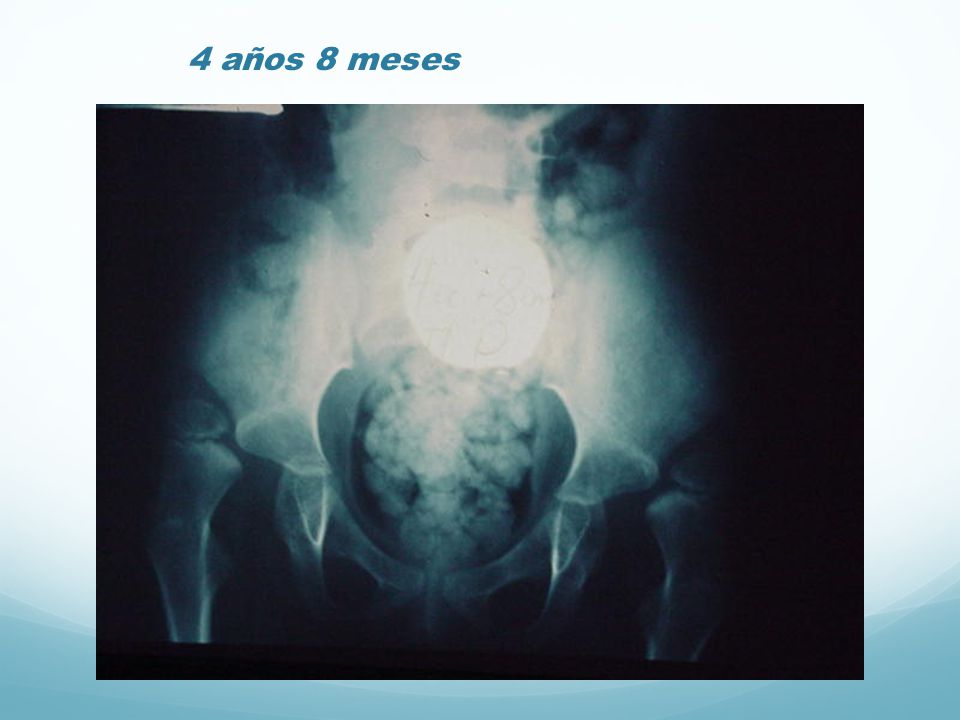 4 años 8 meses
