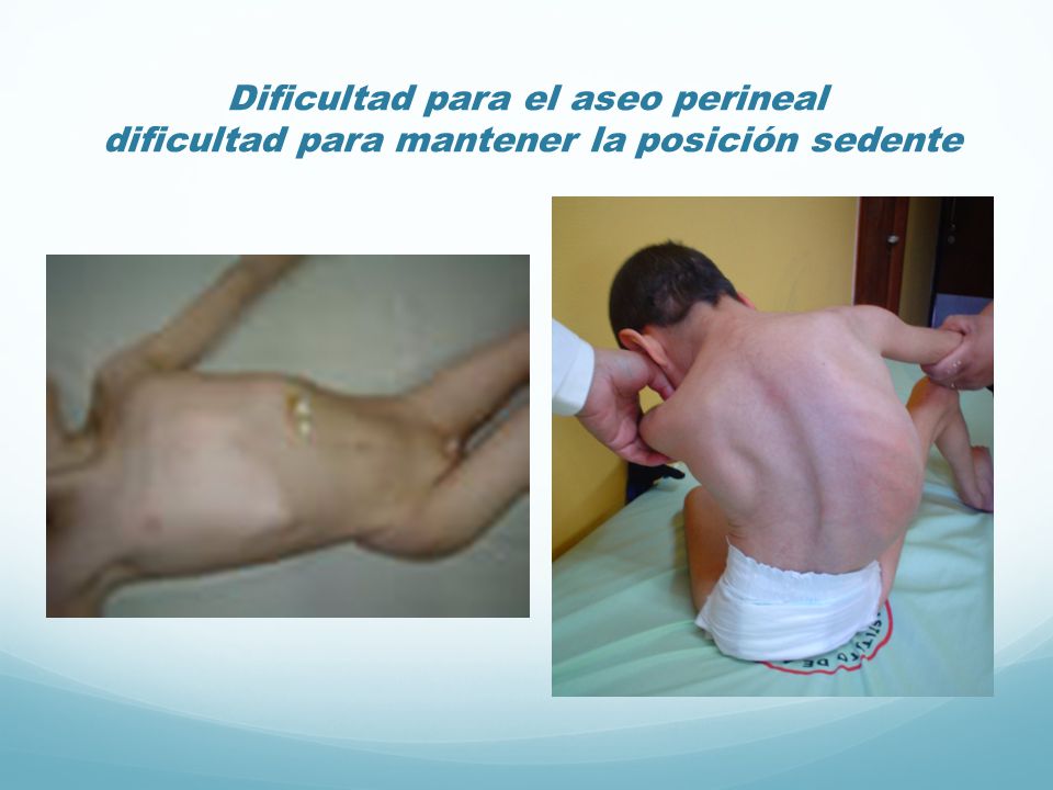 Dificultad para el aseo perineal dificultad para mantener la posición sedente