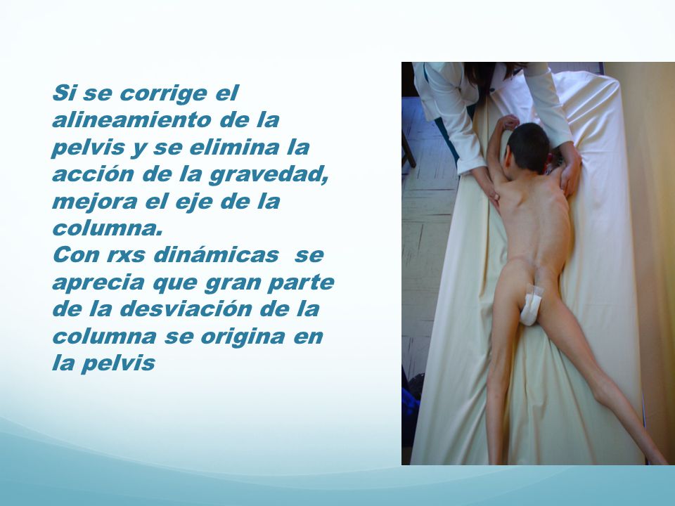 Si se corrige el alineamiento de la pelvis y se elimina la acción de la gravedad, mejora el eje de la columna.