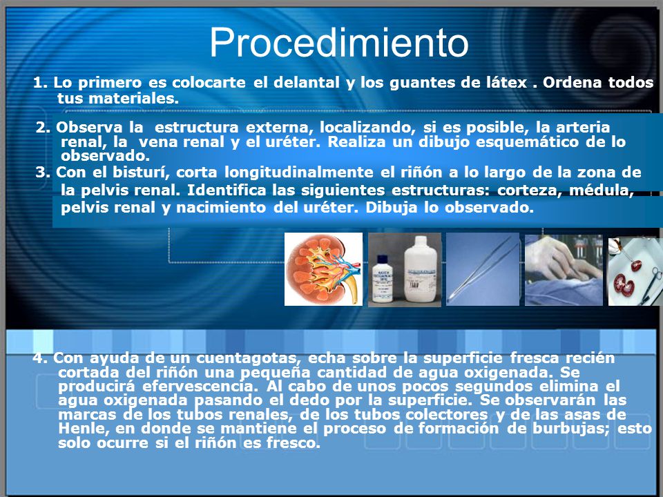 Procedimiento 1. Lo primero es colocarte el delantal y los guantes de látex . Ordena todos tus materiales.