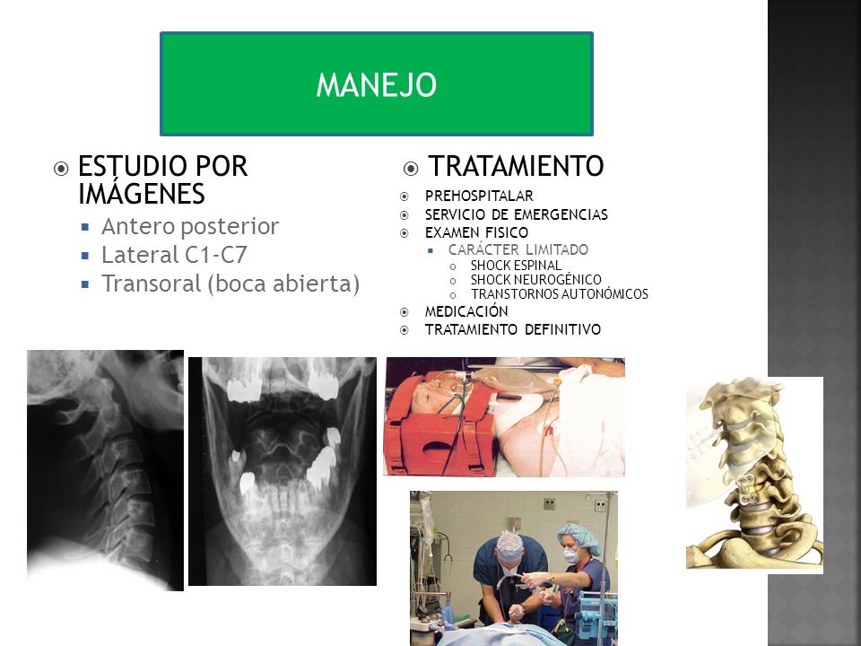 MANEJO ESTUDIO POR IMÁGENES TRATAMIENTO Antero posterior Lateral C1-C7