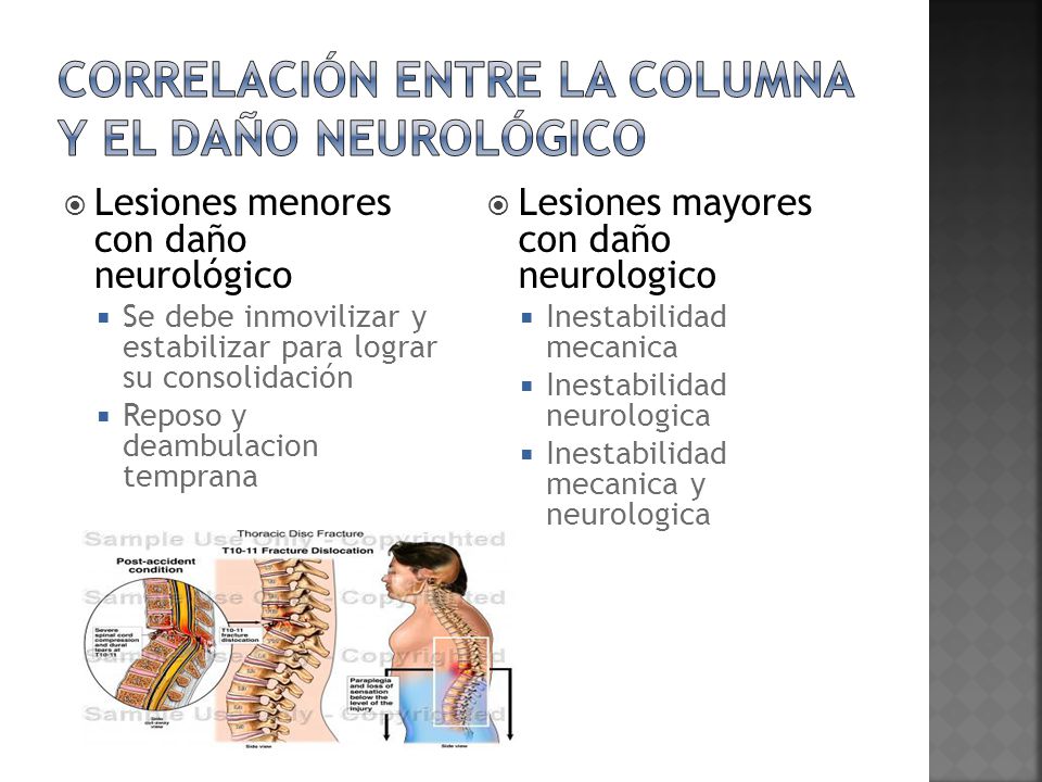 Correlación entre la columna y el daño neurológico