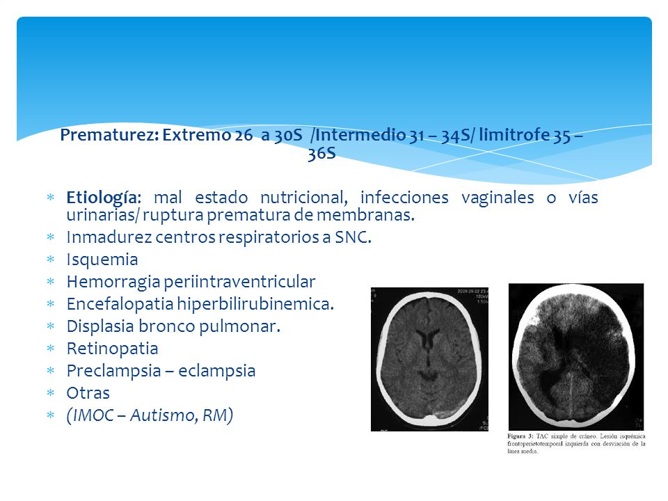 Prematurez: Extremo 26 a 30S /Intermedio 31 – 34S/ limitrofe 35 – 36S