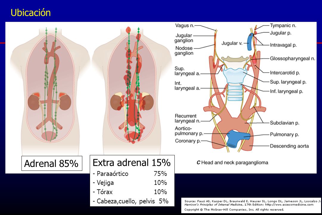 Ubicación Extra adrenal 15% Adrenal 85% - Paraaórtico 75% - Vejiga 10%