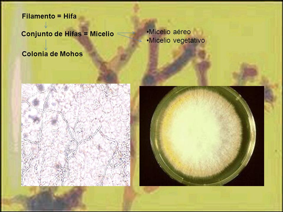 Filamento = Hifa •Micelio aéreo •Micelio vegetativo Conjunto de Hifas = Micelio Colonia de Mohos