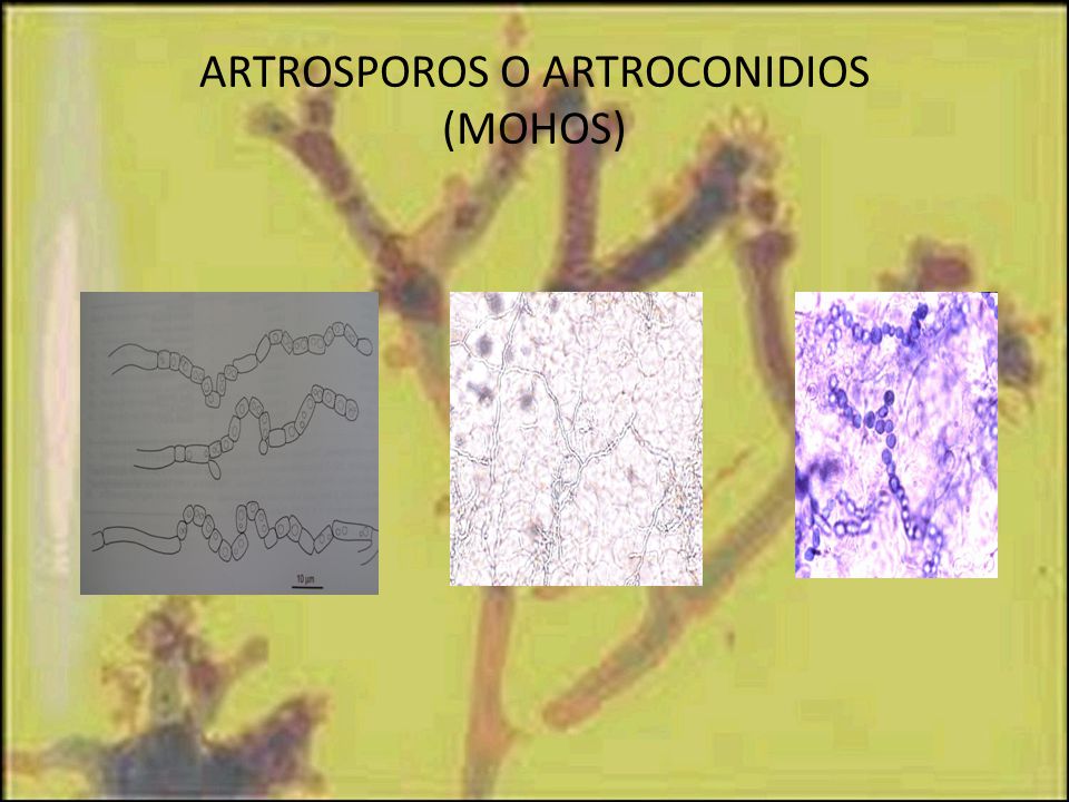 ARTROSPOROS O ARTROCONIDIOS (MOHOS)