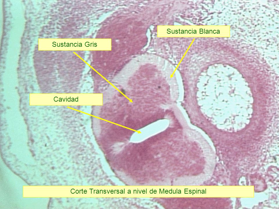 Corte Transversal a nivel de Medula Espinal