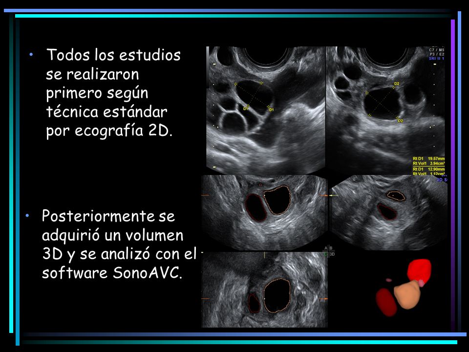 Todos los estudios se realizaron primero según técnica estándar por ecografía 2D.