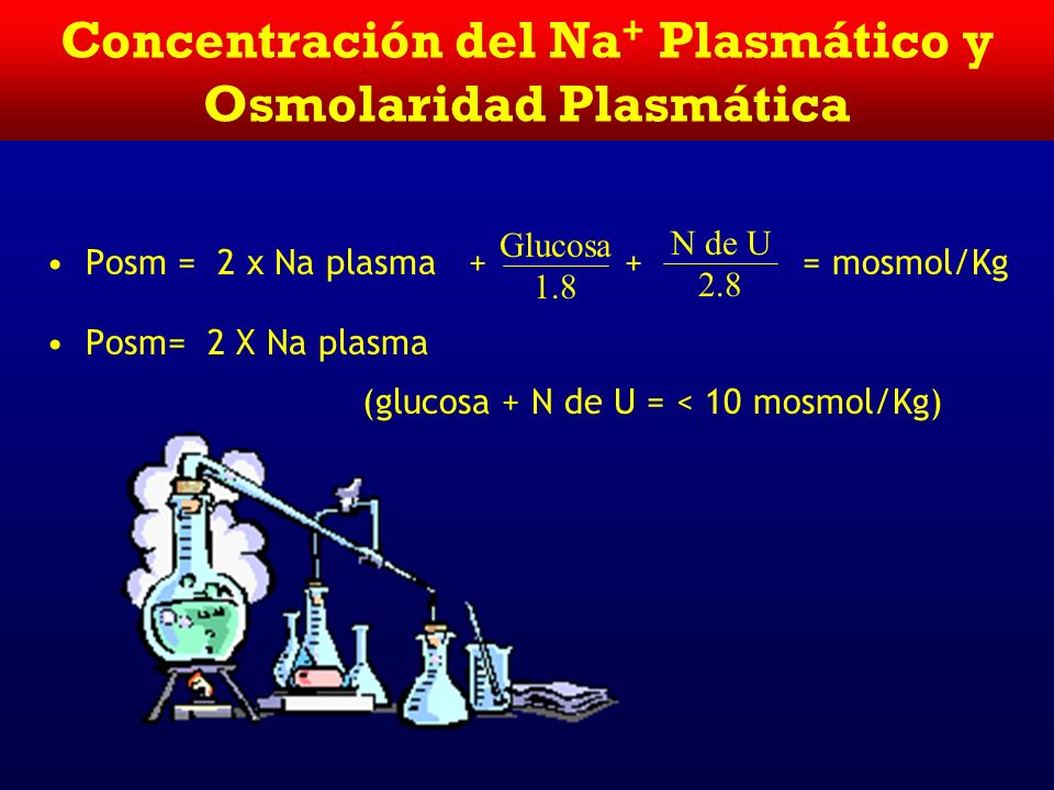 Concentración del Na+ Plasmático y Osmolaridad Plasmática