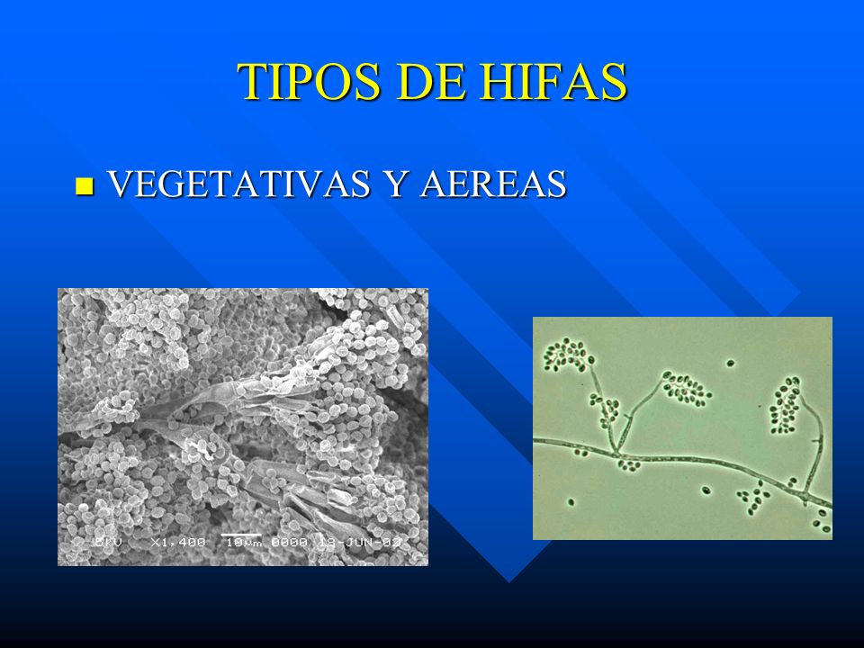TIPOS DE HIFAS VEGETATIVAS Y AEREAS
