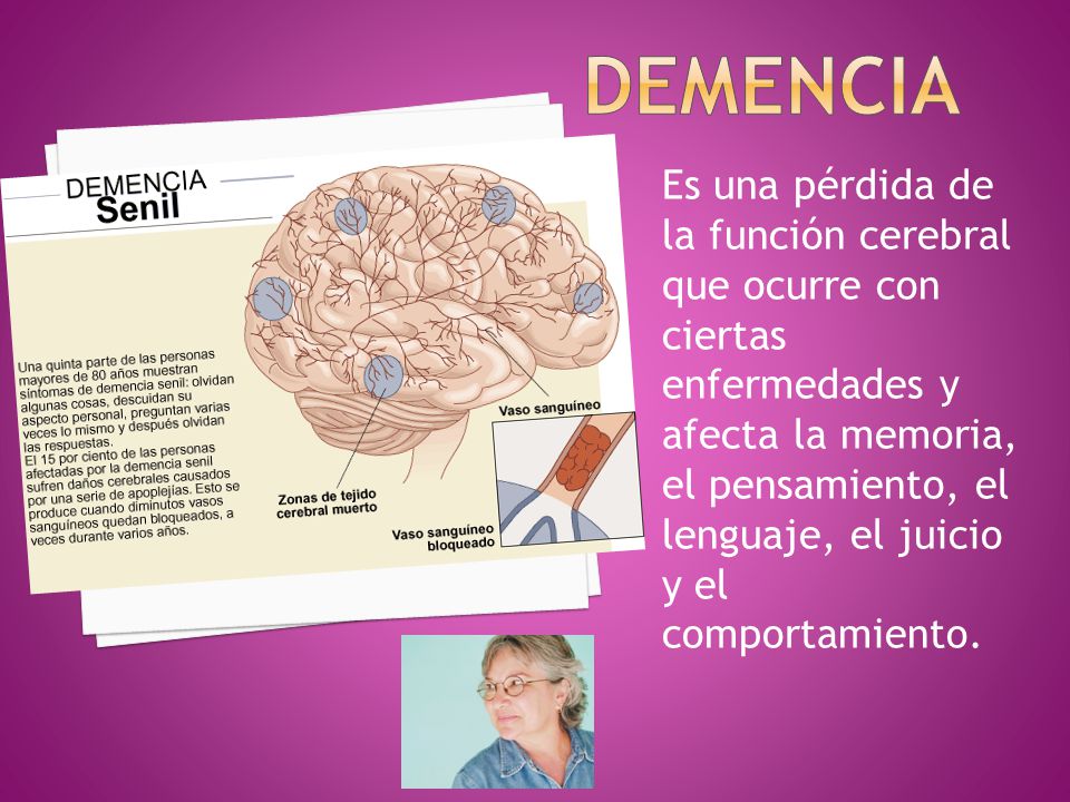 Demencia