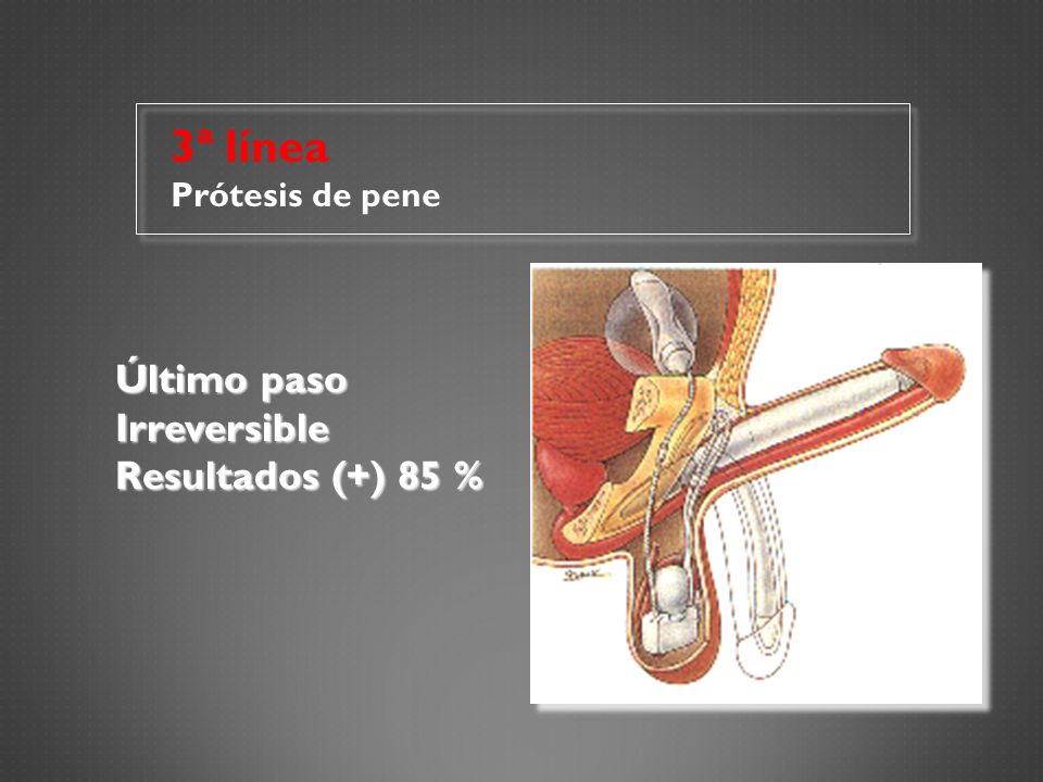 3ª línea Prótesis de pene Último paso Irreversible Resultados (+) 85 %