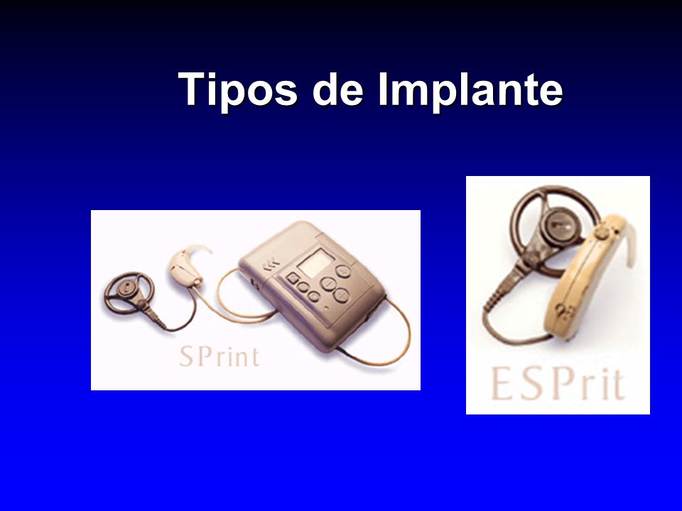 Tipos de Implante