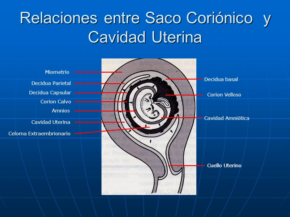 Relaciones entre Saco Coriónico y Cavidad Uterina