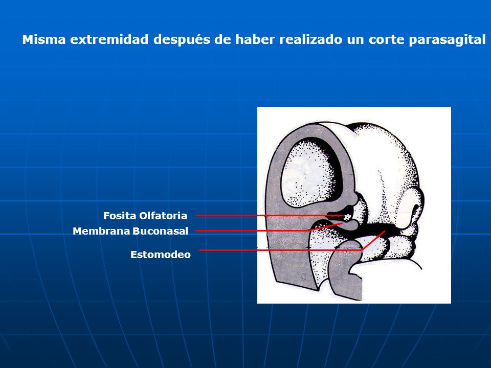 Misma extremidad después de haber realizado un corte parasagital