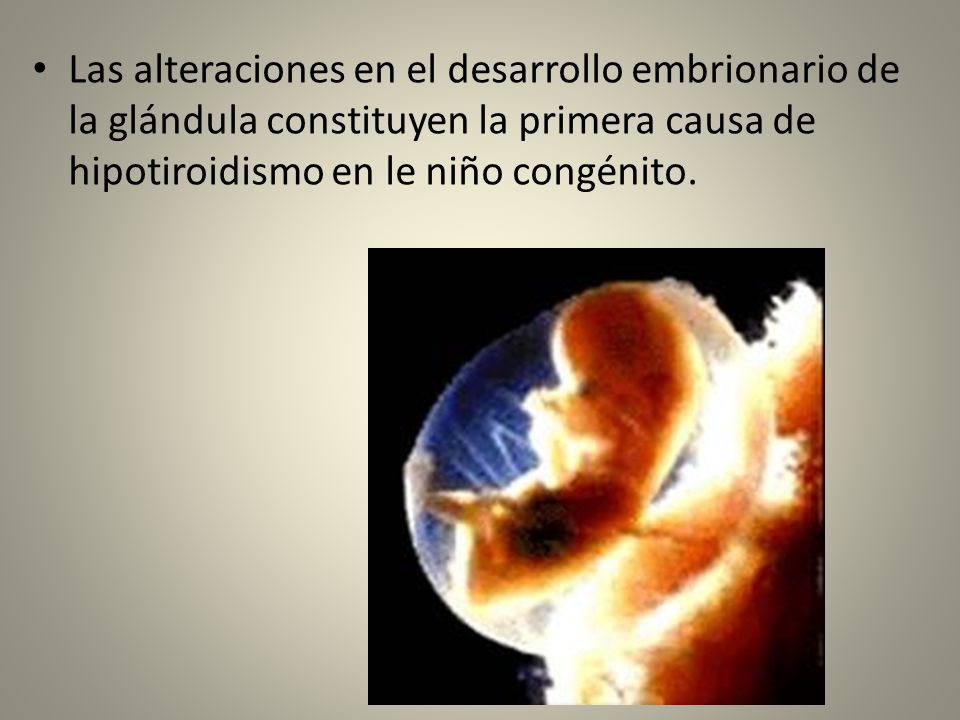 Las alteraciones en el desarrollo embrionario de la glándula constituyen la primera causa de hipotiroidismo en le niño congénito.