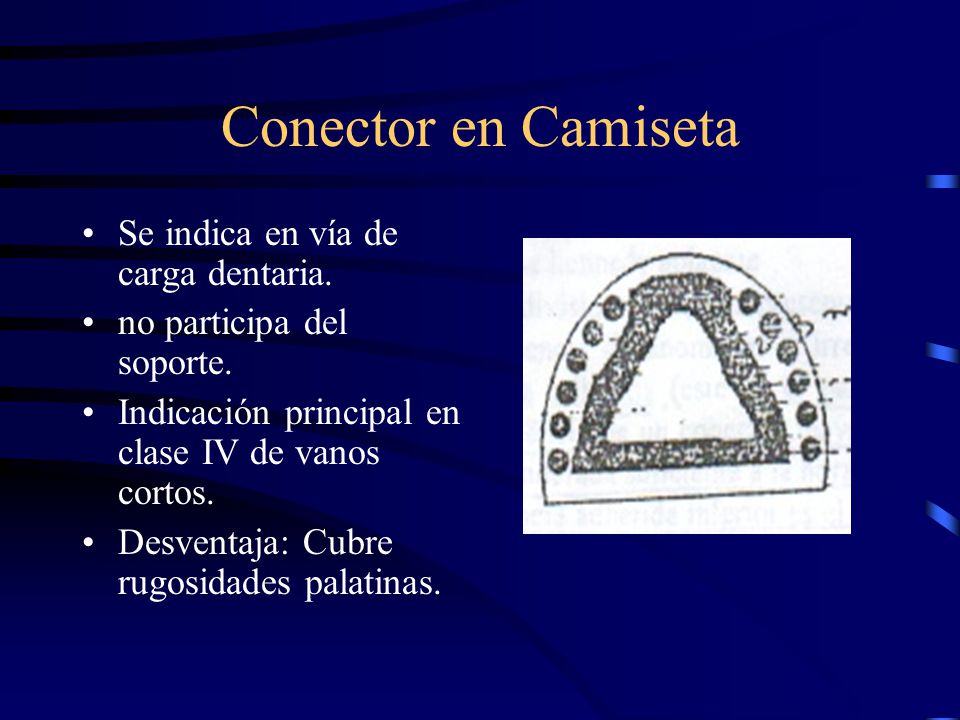 Conector en Camiseta Se indica en vía de carga dentaria.