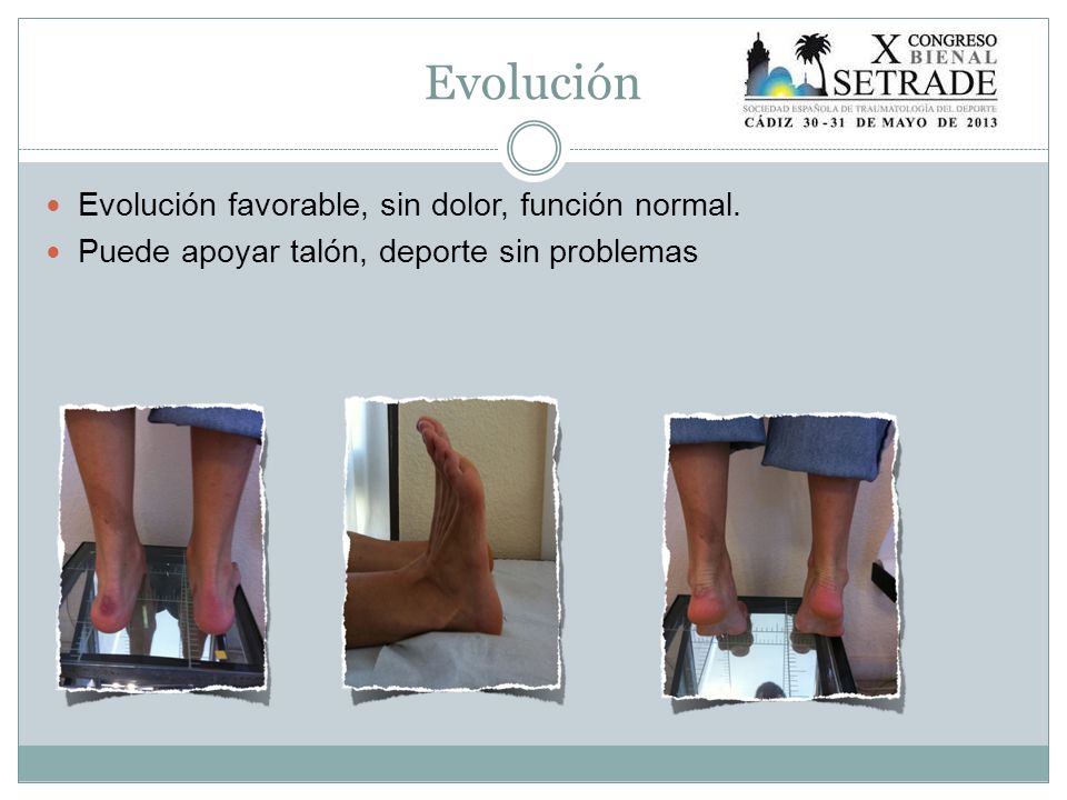 Evolución Evolución favorable, sin dolor, función normal.