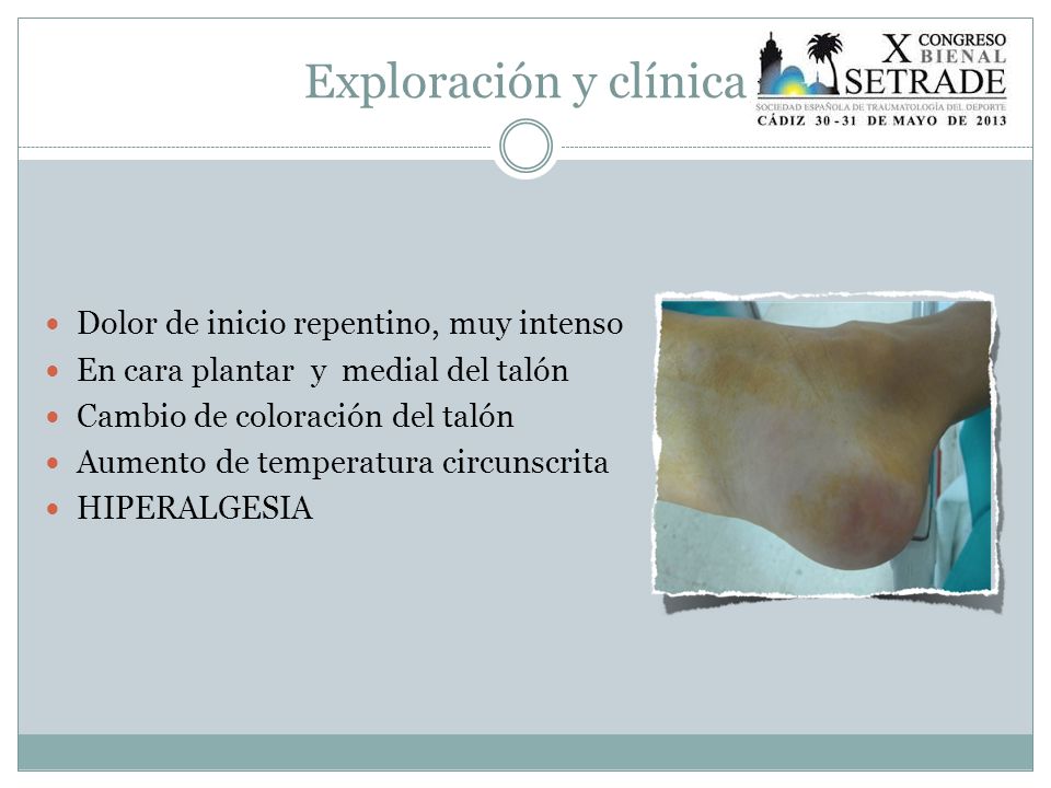 Exploración y clínica Dolor de inicio repentino, muy intenso