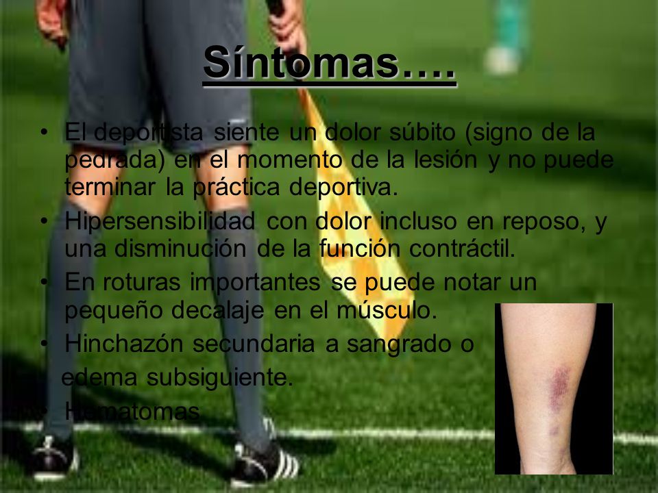 Síntomas…. El deportista siente un dolor súbito (signo de la pedrada) en el momento de la lesión y no puede terminar la práctica deportiva.
