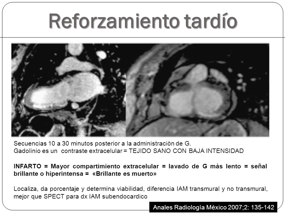 Reforzamiento tardío Secuencias 10 a 30 minutos posterior a la administraciòn de G.
