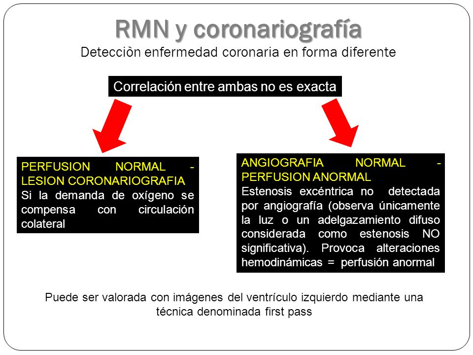 RMN y coronariografía Detecciòn enfermedad coronaria en forma diferente