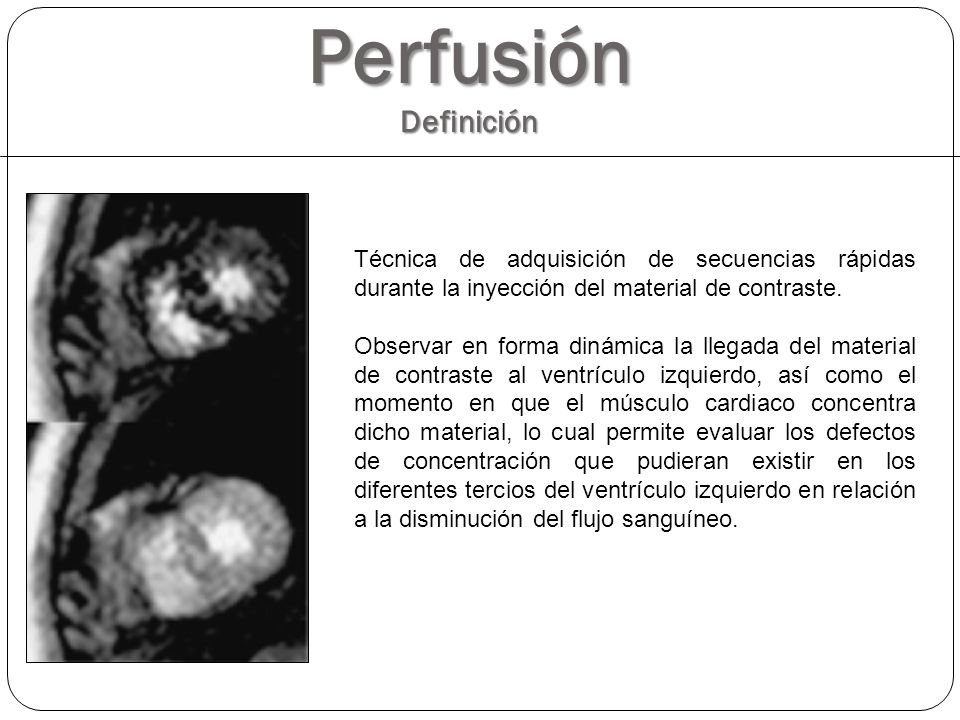 Perfusión Definición Técnica de adquisición de secuencias rápidas durante la inyección del material de contraste.