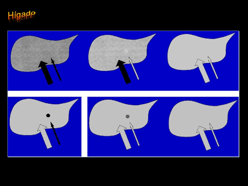 Esquema irrigacion hepat