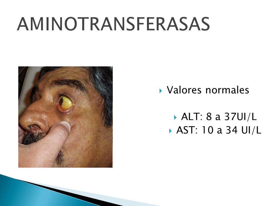 AMINOTRANSFERASAS Valores normales ALT: 8 a 37UI/L AST: 10 a 34 UI/L