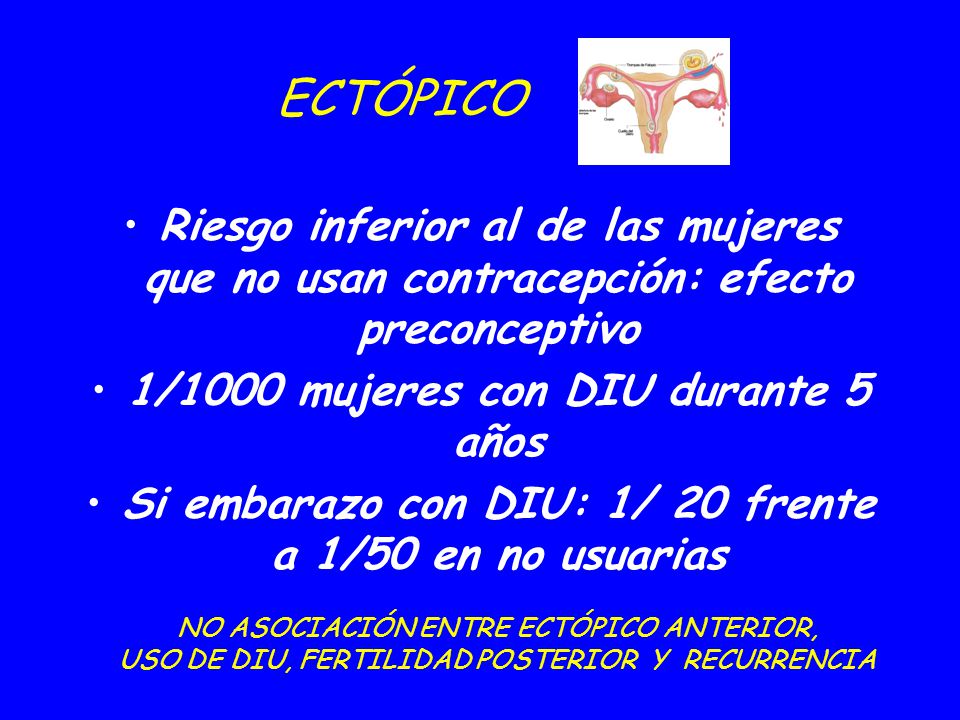 09/04/2017 ECTÓPICO. Riesgo inferior al de las mujeres que no usan contracepción: efecto preconceptivo.
