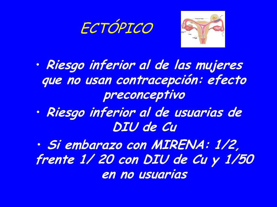 Riesgo inferior al de usuarias de DIU de Cu